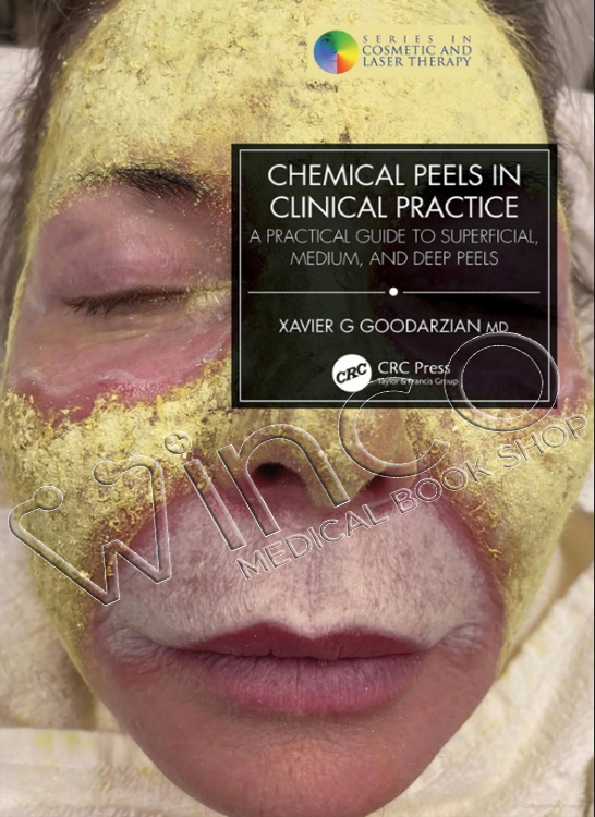 Chemical Peels in Clinical Practice A Practical Guide to Superficial, Medium, and Deep Peels