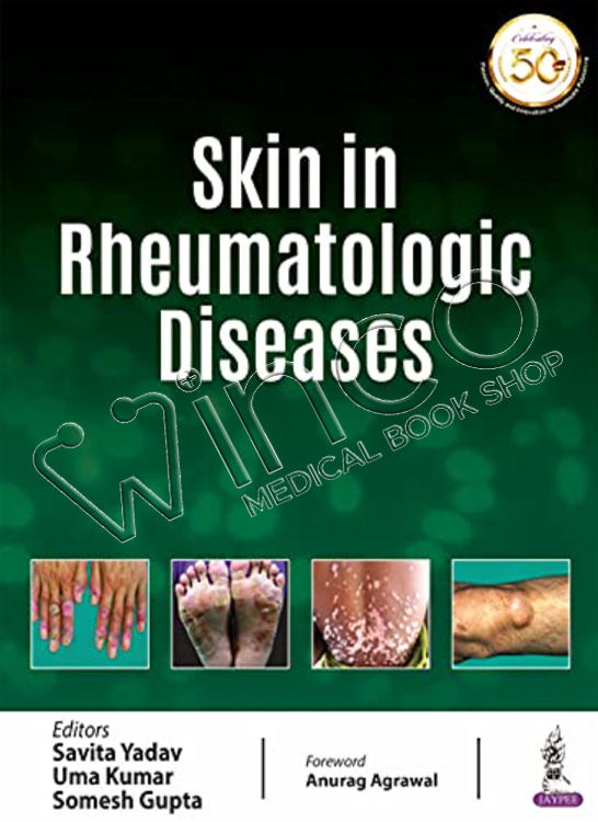 Skin In Rheumatologic Diseases Winco MEDical Book