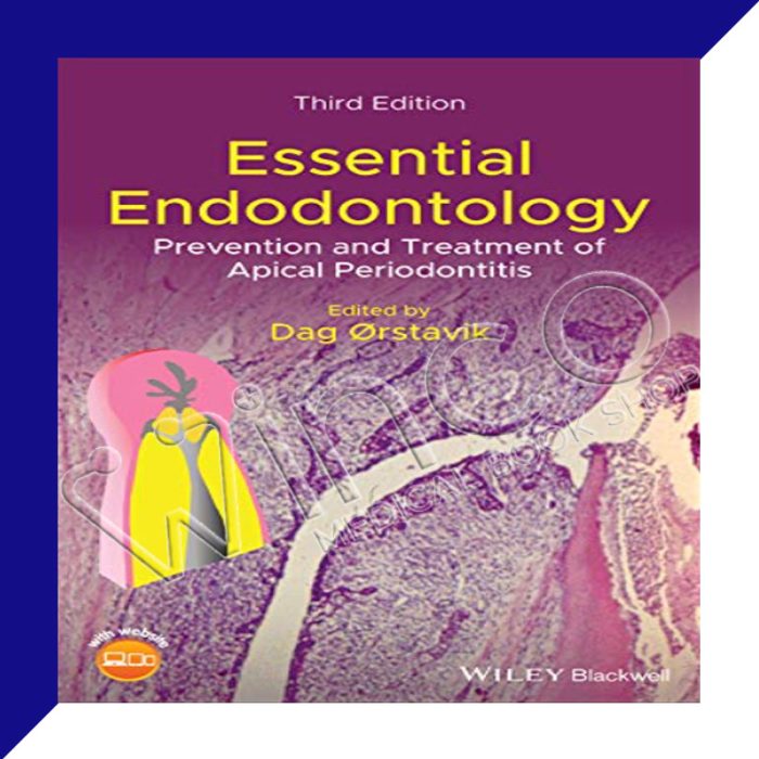 Essential Endodontology Prevention and Treatment of Apical Periodontitis, 3ed