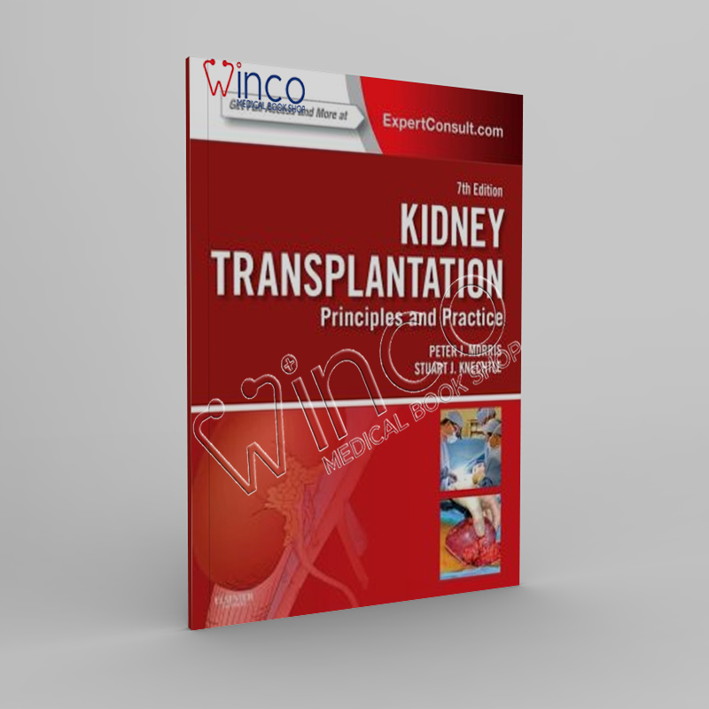Kidney Transplantation – Principles and Practice, 7th Edition