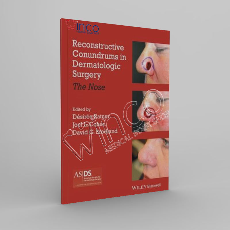 Reconstructive Conundrums in Dermatologic Surgery The Nose
