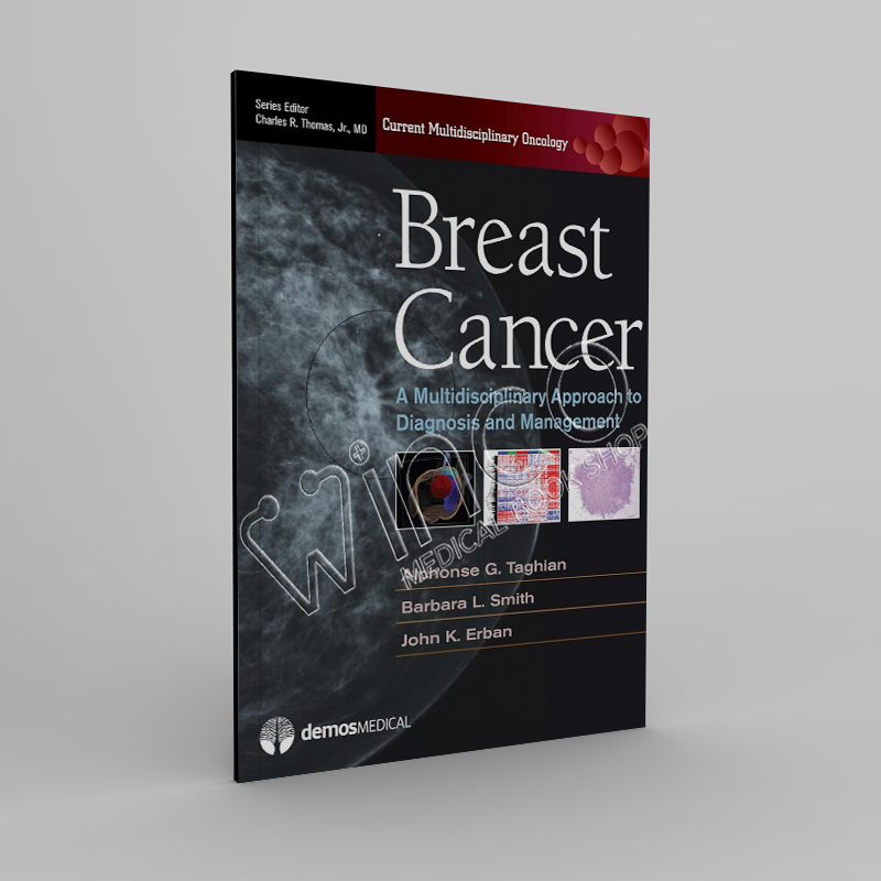 Breast Cancer A Multidisciplinary Approach to Diagnosis and Management