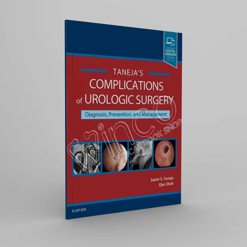 Complications of Urologic Surgery.