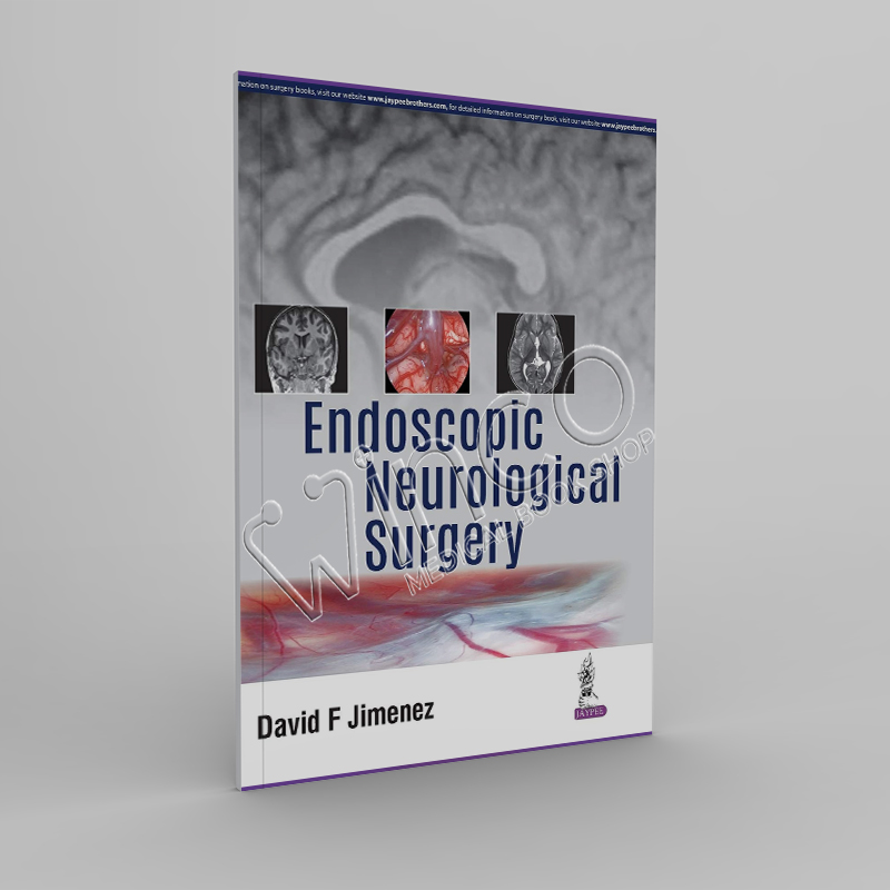 Endoscopic Neurological Surgery 1st Edition