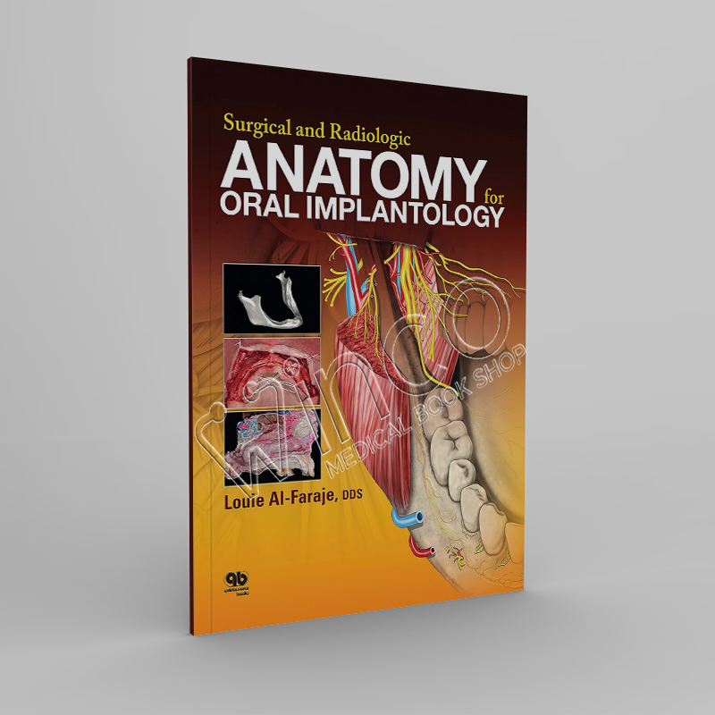 Surgical and Radiologic Anatomy of Oral Implantology 1st edition