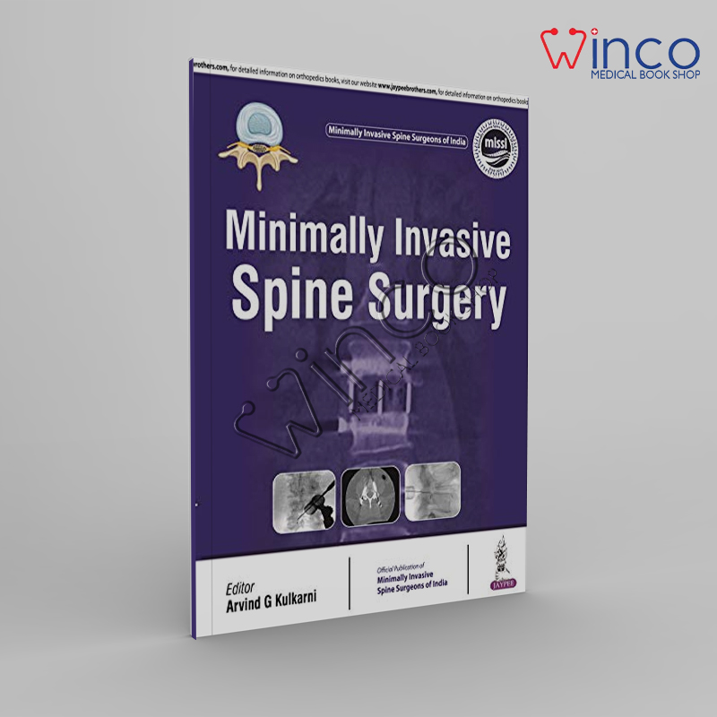 Minimally Invasive Spine Surgery Winco Medical Online Book.jpg