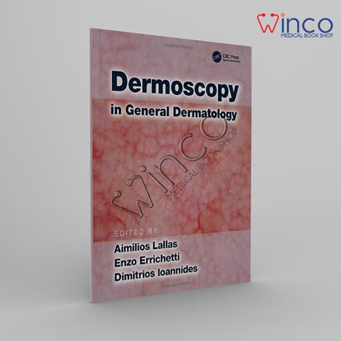 Dermoscopy In General Dermatology Winco Online Medical Book