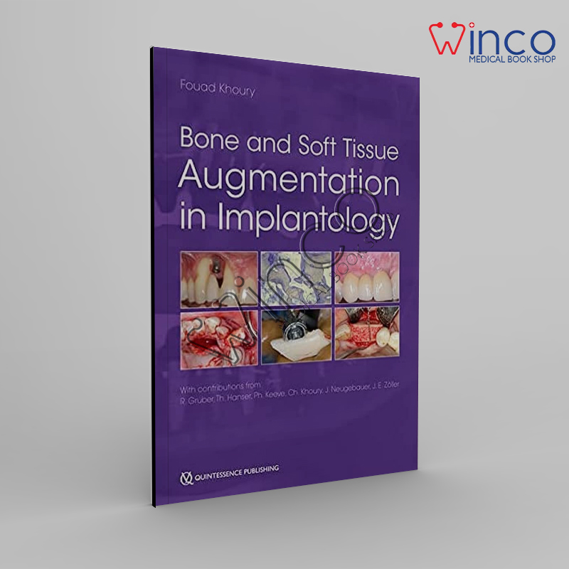 Bone and Soft Tissue Augmentation in Implantology 1st Edition Winco Online Medical Book