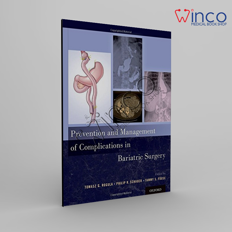 Prevention And Management Of Complications In Bariatric Surgery Winco Online Medical Book
