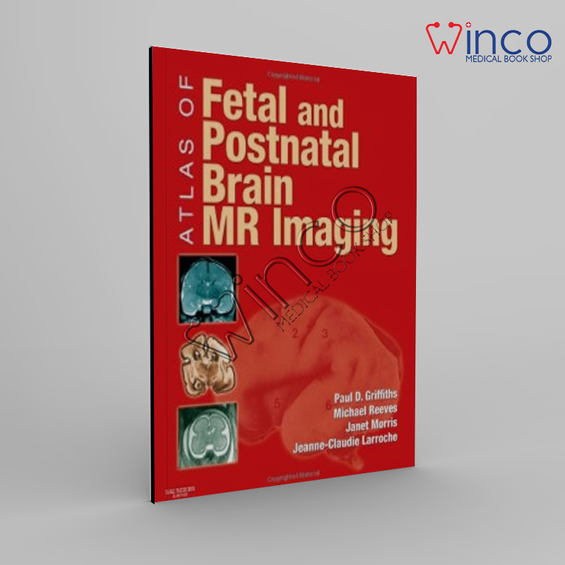 Atlas Of Fetal And Postnatal Brain MR Imaging