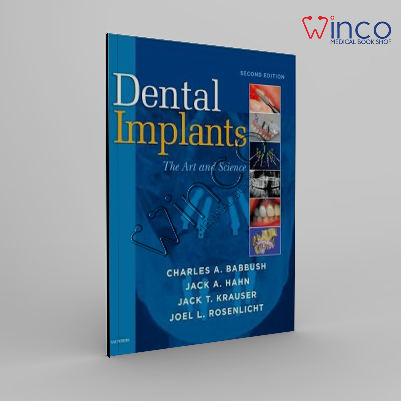 Dental Implants: The Art And Science, 2nd Edition