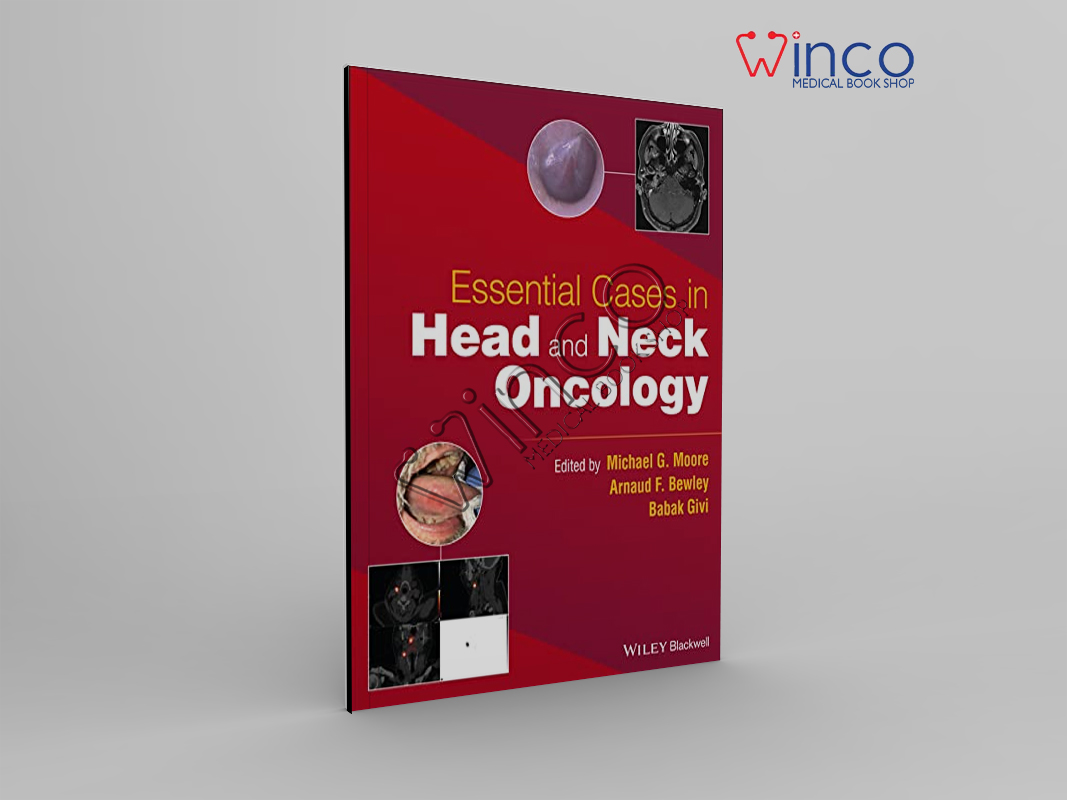 Essential Cases In Head And Neck Oncology