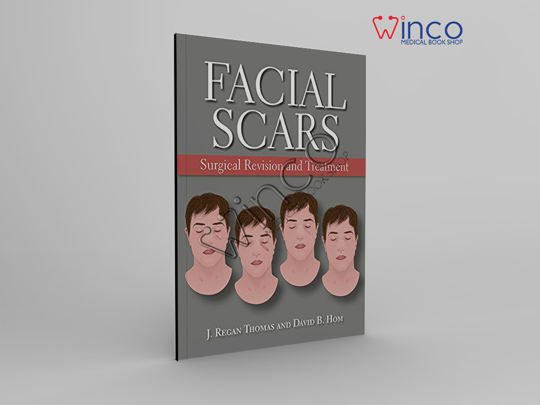 Facial Scars: Surgical Revision And Treatment