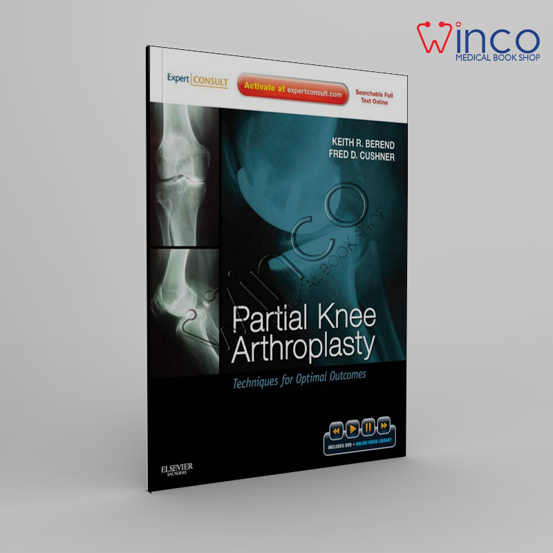 Partial Knee Arthroplasty: Techniques For Optimal Outcomes