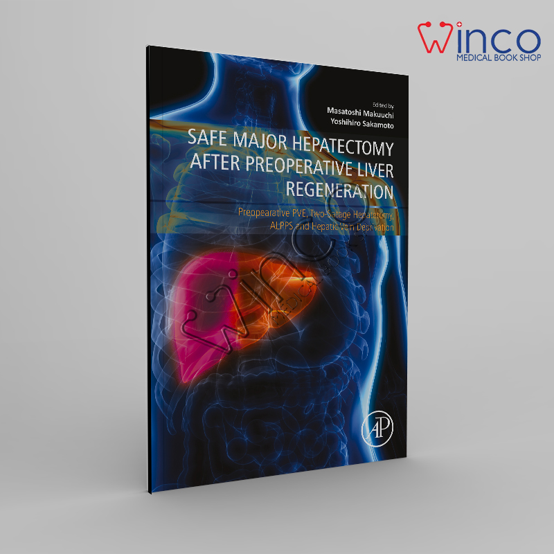 Safe Major Hepatectomy After Preoperative Liver Regeneration: Preopearative PVE, Two-Satage Hepatetomy, ALPPS And Hepatic Vein Deprivation
